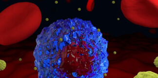 Kanser Belirtileri Nelerdir?