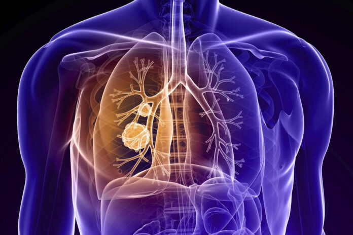 Koah-nedir-koah-tedavisi
