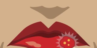 Uçuk Belirtileri Nelerdir? Bulaşıcı Mıdır?