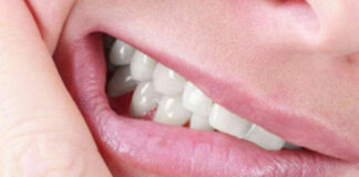 Uyurken Diş Gıcırdatma (Bruksizm) Nedir? Tedavisi Nelerdir?