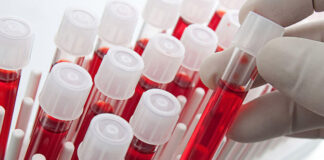 Dört Kan Grubu için Yararlı ve Zararlı Besinler!