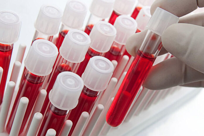 dort-kan-grubu-icin-yararli-ve-zararli-besinler1