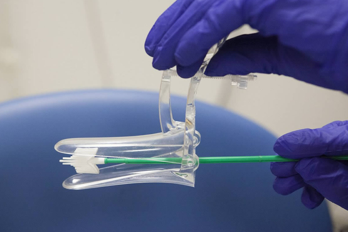 smear testi nedir neden gerekli 1