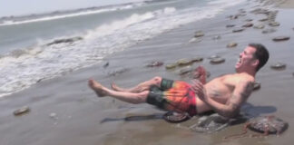 Denizanası Çarpması Tedavisi Nasıl Yapılmalıdır?