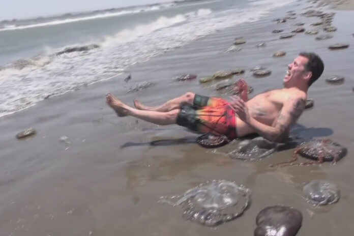 Denizanası-carpmasi-tedavisi-nasil-yapilmalidir