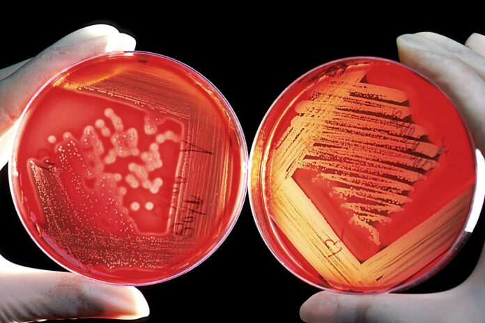 Dogum-sırasındaki-enfeksiyona-dikkat
