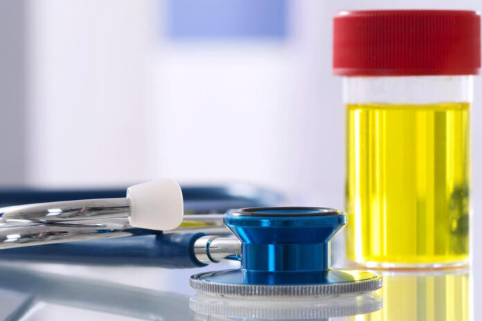 Normal-idrar-rengi-nasil-olmali