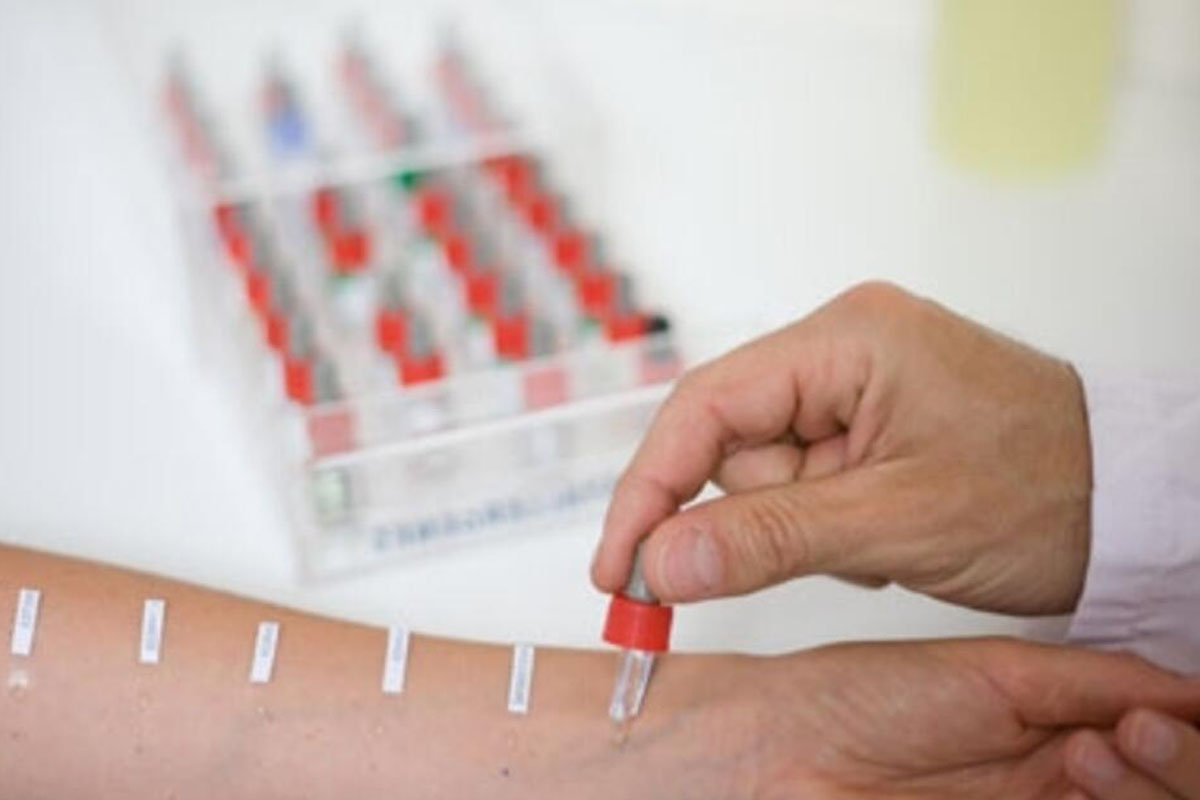 besin testi ve zayiflama1