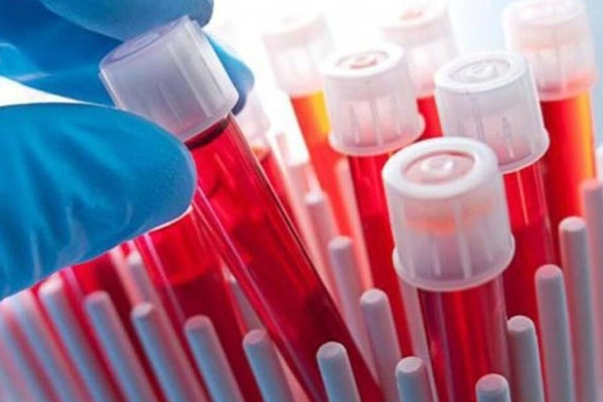 crp nedir ve kan tahlilinde crp degerleri 1