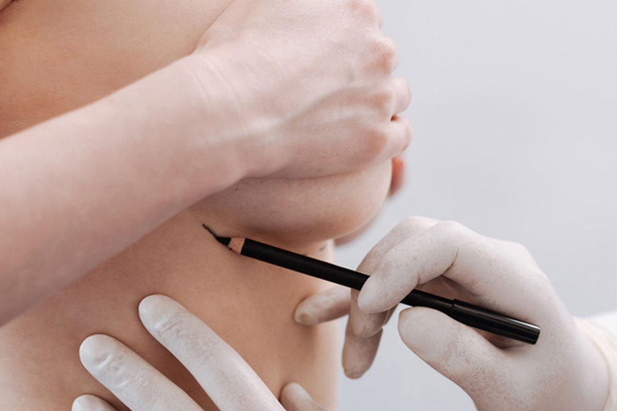 Meme, Göğüs Küçültme Yöntemleri